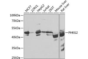 Western blot analysis of extracts of various cell lines, using PHKG2 antibody  at 1:1000 dilution.