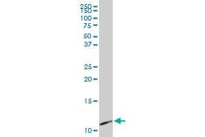 PPBP MaxPab rabbit polyclonal antibody. (CXCL7 antibody  (AA 1-128))
