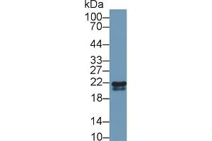 Western blot analysis of Cow Kidney lysate, using Rabbit Anti-Cow RBP4 Antibody (1 µg/ml) and HRP-conjugated Goat Anti-Rabbit antibody (abx400043, 0. (RBP4 antibody  (AA 19-201))
