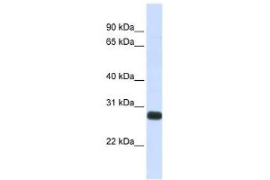 SPINT2 antibody used at 1 ug/ml to detect target protein. (SPINT2 antibody  (Middle Region))