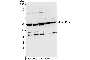 anti-serine Hydroxymethyltransferase 2 (Mitochondrial) (SHMT2) (AA 454-504) antibody