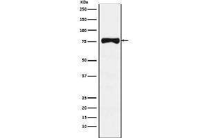 Western blot analysis of TRP1 expression in Human melanoma lysate.