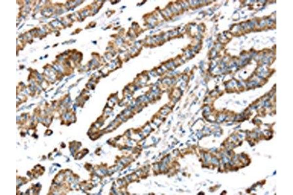 LTB4R2 antibody