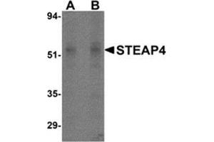 Western blot analysis of STEAP4 in rat liver tissue lysate with STEAP4 antibody at (A) 0.