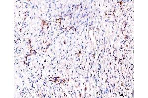 IHC analysis of CD93 using anti-CD93 antibody (ABIN7602865). (CD93 antibody  (C-Term))