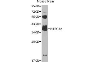 Western blot analysis of extracts of mouse brain, using NT5C3A antibody (ABIN6294220) at 1:1000 dilution.