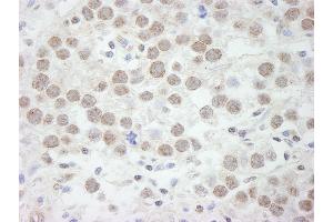 Immunohistochemistry (IHC) image for anti-DEAD (Asp-Glu-Ala-Asp) Box Polypeptide 17 (DDX17) (C-Term) antibody (ABIN7448513)