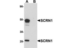 Western blot analysis of SCRN1 in human kidney tissue lysate with SCRN1 antibody at 1 μg/ml in (A) the absence and (B) the presence of blocking peptide. (Secernin 1 antibody  (C-Term))