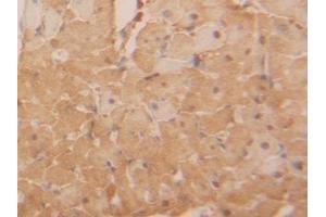 Detection of LDHB in Rat Heart Tissue using Polyclonal Antibody to Lactate Dehydrogenase B (LDHB) (LDHB antibody  (AA 1-334))