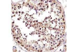 TSPY antibody immunohistochemistry analysis in formalin fixed and paraffin embedded human testis tissue. (TSPY1 antibody  (AA 274-303))