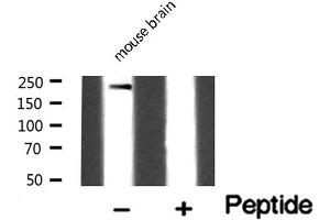 Western blot analysis of Dysferlin expression in Mouse brain lysate (Dysferlin antibody  (C-Term))