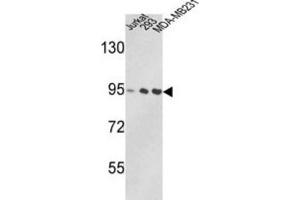 Western Blotting (WB) image for anti-Valosin Containing Protein (VCP) antibody (ABIN3002881)