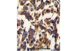 Immunohistochemistry (IHC) image for anti-Berardinelli-Seip Congenital Lipodystrophy 2 (Seipin) (BSCL2) antibody (ABIN2995527)
