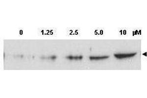 Western blot using  Affinity Purified anti-Chk2 pT68 antibody shows detection of a predominant band at ~60 kDa corresponding to phosphorylated Chk2 (arrowhead) in MCF-7 whole cell lysates after treatment with doxorubicin. (CHEK2 antibody  (pThr68))