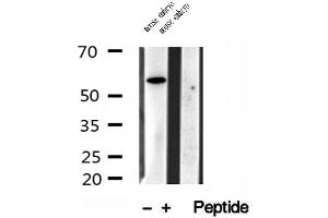 Western blot analysis of extracts of mouse embryo tissue, using TCTN1 antibody. (TCTN1 antibody  (N-Term))