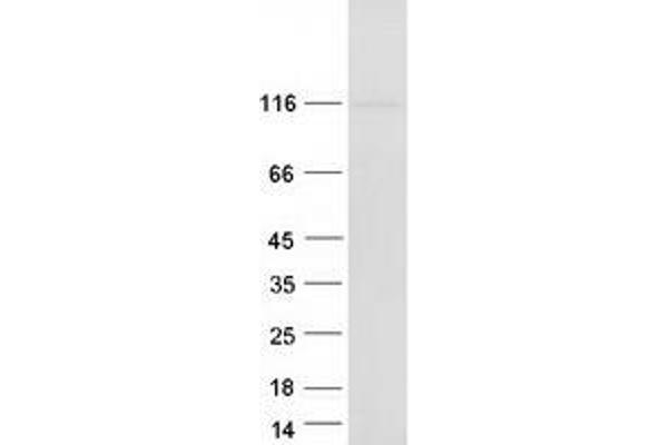 BICC1 Protein (Myc-DYKDDDDK Tag)