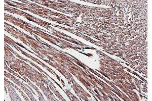IHC analysis of ALDOA using anti-ALDOA antibody (ABIN7601907). (ALDOA antibody  (AA 50-364))