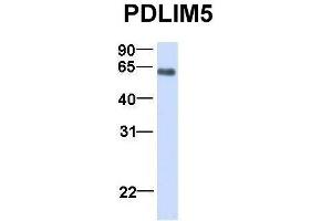 Host:  Rabbit  Target Name:  PDLIM5  Sample Type:  Human Fetal Lung  Antibody Dilution:  1.