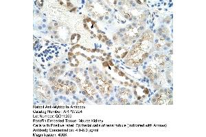 Mouse Lung (MYBBP1A antibody  (C-Term))