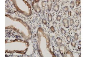 Immunoperoxidase of monoclonal antibody to ADAM17 on formalin-fixed paraffin-embedded human small Intestine. (ADAM17 antibody  (AA 215-314))