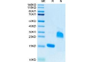 Rat GDF15 on Tris-Bis PAGE under reduced (R) condition and Non reducing (N) condition. (GDF15 Protein (AA 189-303) (His tag))