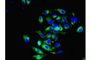Immunofluorescent analysis of A549 cells using ABIN7149470 at dilution of 1:100 and Alexa Fluor 488-congugated AffiniPure Goat Anti-Rabbit IgG(H+L) (DRD5 antibody  (AA 361-477))
