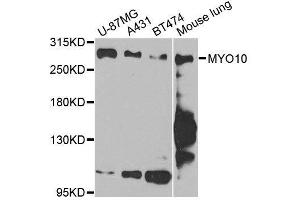 Western blot analysis of extracts of various cell lines, using MYO10 antibody. (Myosin X antibody  (AA 845-944))