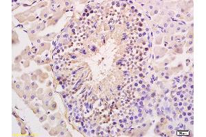 Formalin-fixed and paraffin embedded rat testis labeled with Anti REC8 Polyclonal Antibody, Unconjugated (ABIN873082) at 1:200 followed by conjugation to the secondary antibody and DAB staining (REC8 antibody  (AA 22-120))