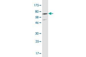 Western Blot detection against CHD11-His tag (61.