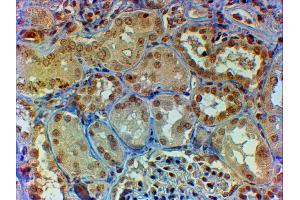 Immunohistochemistry (IHC) image for anti-V-Myb Myeloblastosis Viral Oncogene Homolog (Avian) (MYB) (AA 281-294) antibody (ABIN5929019) (MYB antibody  (AA 281-294))