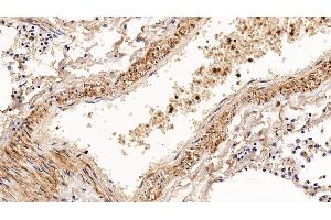 Detection of CNN1 in Human Lung Tissue using Polyclonal Antibody to Calponin 1, Basic (CNN1) (CNN1 antibody  (AA 1-268))