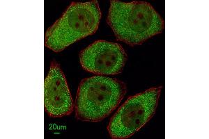 Immunofluorescence (IF) image for anti-Arachidonate 12-Lipoxygenase (ALOX12) antibody (ABIN3003946) (ALOX12 antibody)