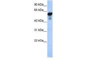 WB Suggested Anti-ALDH1B1 Antibody Titration: 0. (ALDH1B1 antibody  (Middle Region))