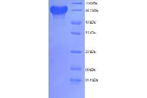 Phosphogluconate Dehydrogenase (PGD) (AA 4-483), (partial) protein (GST tag) (PGD Protein (AA 4-483, partial) (GST tag))