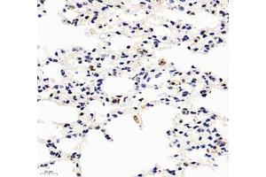 Immunohistochemistry of paraffin embedded mouse lung using HSP70B (ABIN7074173) at dilution of 1: 1000 (400x lens) (HSPA6 antibody)