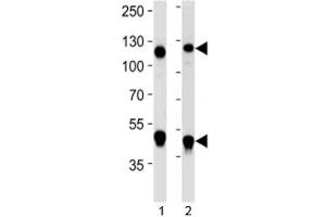 Western blot analysis of lysate from 1) Daudi and 2) Jurkat cell line using NFKB1 antibody at 1:1000. (NFKB1 antibody)