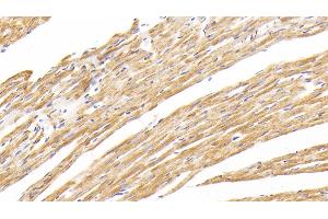 Detection of COX2 in Rat Cardiac Muscle Tissue using Polyclonal Antibody to Cytochrome C Oxidase Subunit II (COX2) (COX2 antibody  (AA 83-227))