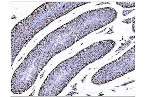 IHC analysis of KMT1B/SUV39H2 using anti-KMT1B/SUV39H2 antibody (ABIN7602135). (SUV39H2 antibody  (AA 6-410))