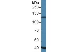 Detection of ADAMTS19 in Porcine Heart lysate using Polyclonal Antibody to A Disintegrin And Metalloproteinase With Thrombospondin 19 (ADAMTS19) (ADAMTS19 antibody  (AA 325-686))