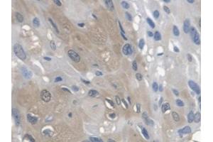DAB staining on IHC-P; Samples: Human Esophagus (Arylsulfatase A antibody  (AA 21-295))