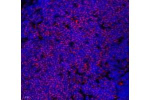 Immunofluorescence of paraffin embedded mouse thymus using Lat (ABIN7074502) at dilution of 1: 2100 (400x lens) (LAT antibody)