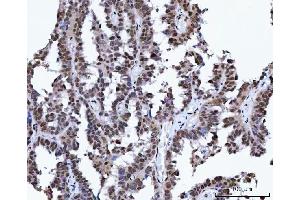 IHC analysis of XRCC4 using anti-XRCC4 antibody (ABIN7599168).