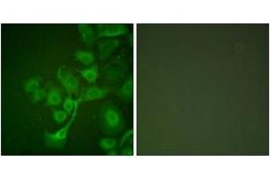 Immunofluorescence analysis of A549 cells, using TIMP2 Antibody. (TIMP2 antibody  (AA 21-70))