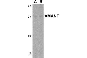 Western Blotting (WB) image for anti-Mesencephalic Astrocyte-Derived Neurotrophic Factor (MANF) (N-Term) antibody (ABIN1031449) (MANF antibody  (N-Term))