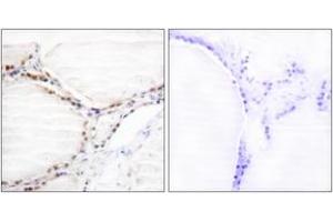 Immunohistochemistry analysis of paraffin-embedded human thyroid gland tissue, using Vitamin D Receptor (Ab-208) Antibody. (Vitamin D Receptor antibody  (AA 181-230))