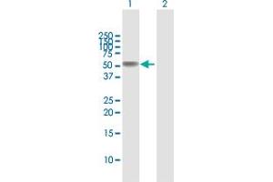 Western Blot analysis of TNFRSF11B expression in transfected 293T cell line by TNFRSF11B MaxPab polyclonal antibody. (Osteoprotegerin antibody  (AA 1-401))