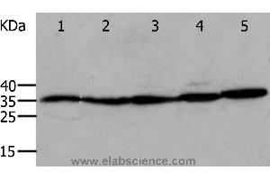 Western blot analysis of Mouse eyes and heart, Human cervical cancer tissue, OP9 and RAW264. (Annexin V antibody)