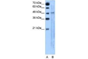 SLC25A46 antibody used at 5 ug/ml to detect target protein.