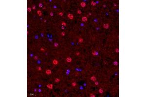 Immunofluorescence of paraffin embedded rat brain using SUV39H1 (ABIN7075770) at dilution of 1:1000 (400x lens)