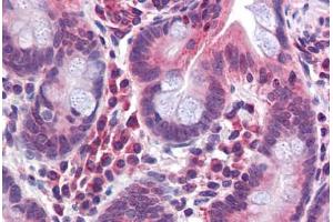 Anti-TMPRSS4 antibody  ABIN1049420 IHC staining of human small intestine. (TMPRSS4 antibody  (N-Term))